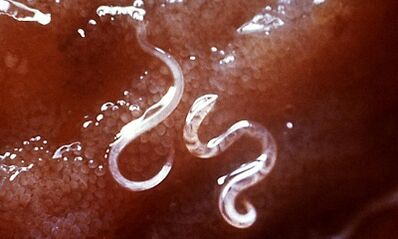 What parasites are in the liver in humans
